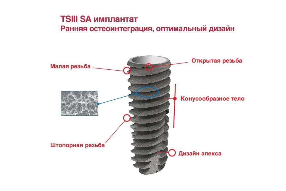 Имплантат Osstem TSIII Regular, D-5,5 мм длина 11.5 мм. — изображение 2