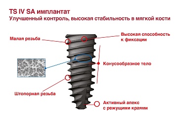 Имплантат Osstem TSIV Regular, D-4,0 мм длина 7 мм. — изображение 2